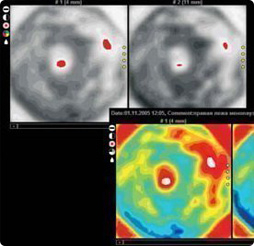 Маммограф МЭМ 20-08