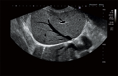 CANON/Toshiba Aplio i700