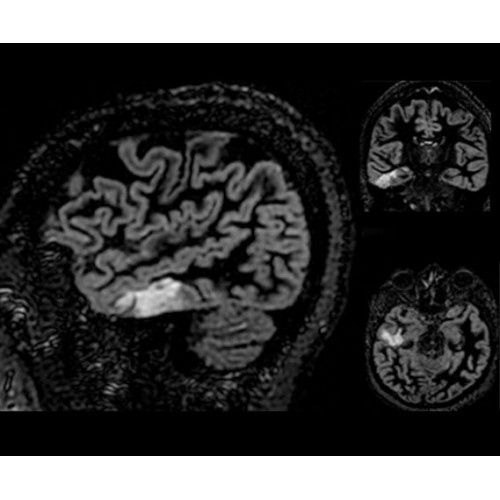 МРТ аппарат GE SIGNA Architect 3.0T