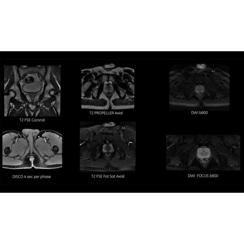 МРТ аппарат GE SIGNA Voyager 1.5T