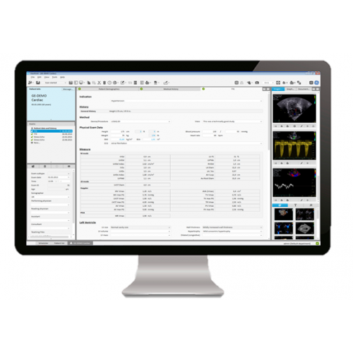 ViewPoint 6 и комплект EchoPAC Suite для кардиологических исследований